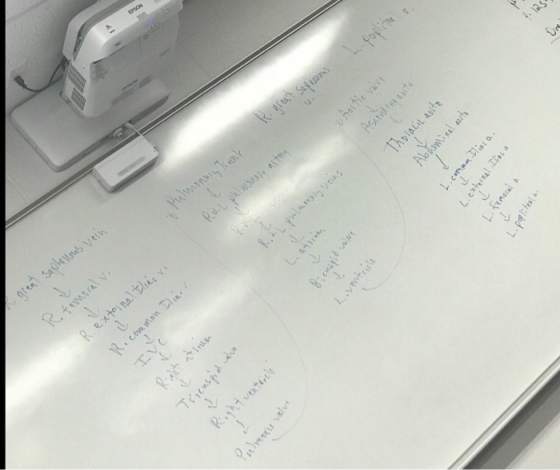 ofel Sapkewaus vein L Pulmonany Truenk farlh R.femral v Rez puiworase ast R.extoinalthit v Lon 4. 125 L. Rghtenterdle ohoitie