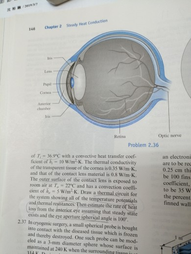沈裕, 2019/3/7 Steady Heat Conduction Chapter 2 146 Less Pupil Cornea Antenor Retina Optic nerve Problem 2.36 of T, = 36.9°C wi