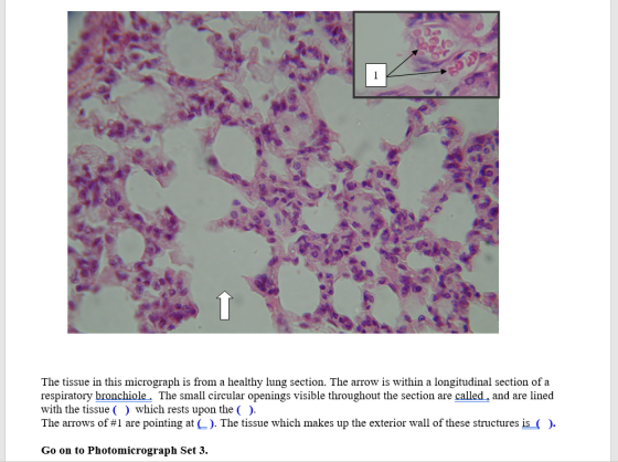 1 The tissue in this micrograph is from a healthy lung section. The arrow is within a longitudinal section of a respiratory b