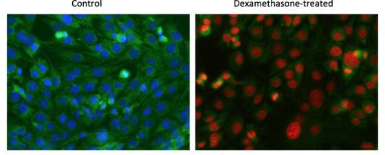 Control Dexamethasone-treated