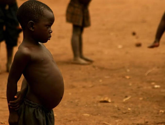 malnutrition3.jpg