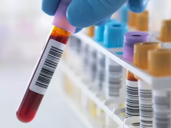 Blood and Urine Test Measure BAC