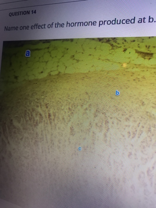 QUESTION 14 Name one effect of the hormone produced at b.