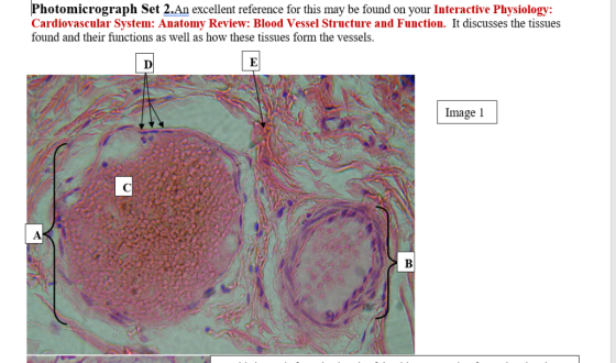 Photomicrograph Set 2.An excellent reference for this may be found on your Interactive Physiology: Cardiovascular System: Ana