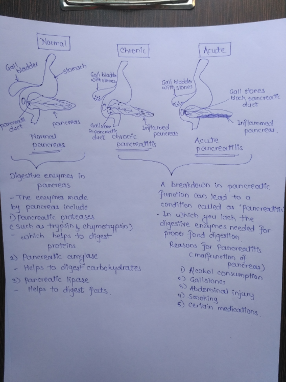 Normal 1 Chronic Acute Galladder -stomach Gall bladde toith stones Gall bladder with stones Gall stones block pancreatic duct
