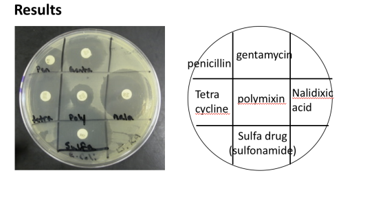 Results gentamycin penicillin Tetra polymixin Nalidixid cycline acid PAN SA Sulfa drug (sulfonamide)