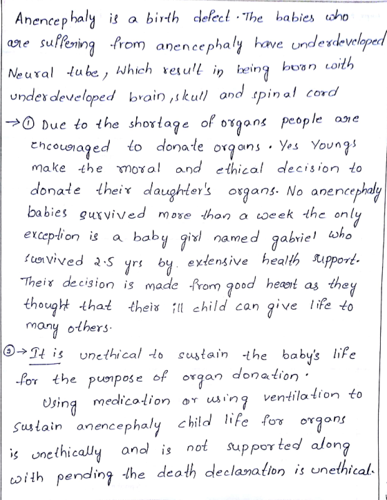 Anencephaly is a birth delect · The babies who are are suffering from anencephaly have underdeveloped Neural tube, which resu
