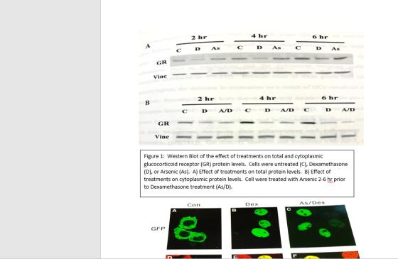 D Asc D As c D As GR Vinc 2 hr 4 hr 6 hr CD A/D CDA/D C D A/D GR Vinc Figure 1: Western Blot of the effect of treatments on t