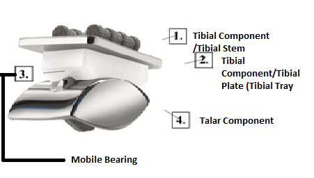 Tibial Component Tibial Stem 2 Tibial Component/Tibial Plate (Tibial Tray 3. 4.Talar Component Mobile Bearing
