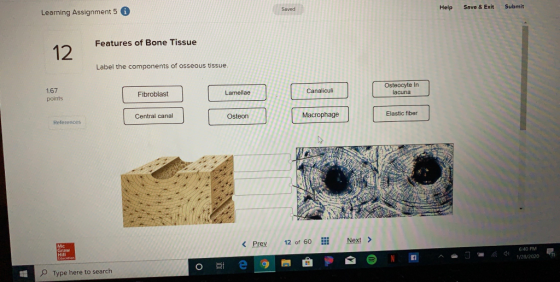 Learning Assignment 5 Saved Help Exit Submit Features of Bone Tissue 12 Label the components of osseous tissue. 1.67 points F