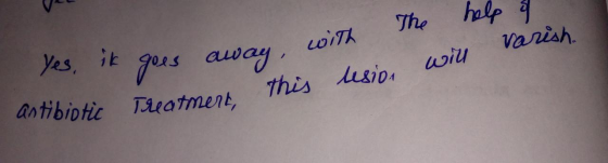 the help & o will varish goes away, with Treatment this lesion . Ik antibiotic