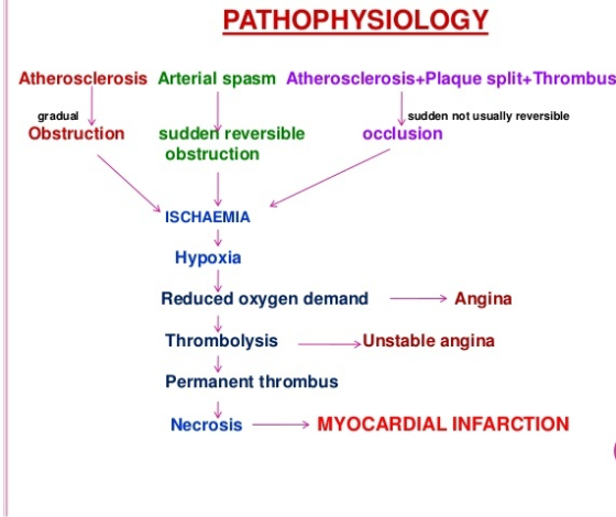PATHOPHYSIOLOGY Atherosclerosis Arterial spasm Atherosclerosis+Plaque split+Thrombus gradual Obstruction sudderni reversible sudden not usually reversible occlusion obstruction ISCHAEMIA Hypoxia Reduced oxygen demandAngina ThrombolysisUnstable angina Permanent thrombus NecrosisMYOCARDIAL INFARCTION