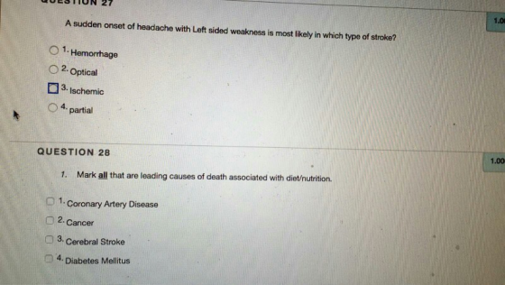 UESTIUN 27 1.0 A sudden onset of headache with Left sided weakness is most likely in which type of stroke? O 1. Hemorrhage O