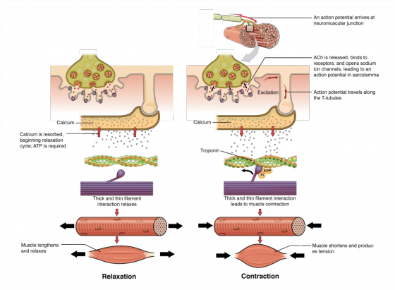 An action potential arrives at neuromuscular junction ACh is released, binds to receptors, and opens sodium ion channels, lea