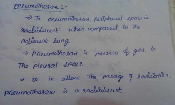 pneumothorar: - In pneumothoran, peripheral span is rachiducent when compared to the adjacent leung » pneumothoran o presence