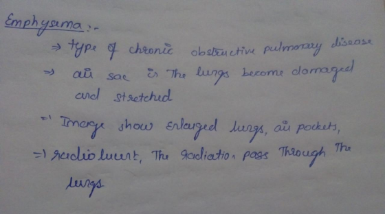 Emphyama. - type of chronic obstructive pulmonary disease & au sac is the lungs become damaged and stretched Imerge show enla