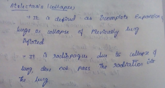 Atelectasis I collapse) It is defined ces Encomplete Expansion ar lungs or collapse of previously being inflated et do > Il å