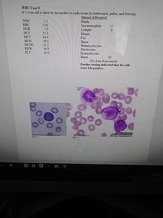 WBC Case S A 5-year-old is taken by his mother to a physician for listlessness, pallor, and bruising. WBC RBC HGB HCT MCV MCH