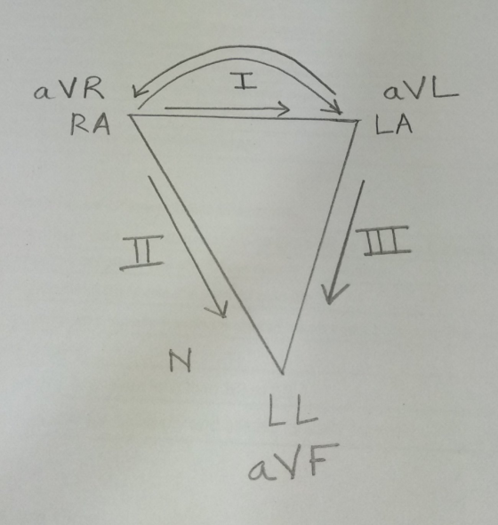 I aVL a VR RA LA N LL aVF
