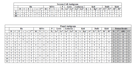 Screen Cell Antigram Rh MNSs PLewis Lutheran Lu Lub Kell Duffv Kidd Panel Antigrann wis Lutheran Rh MNSs Kell Duffy Kidd Patient Results 1000 00 0000000 00 0 02+