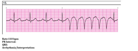 اممممممله Rate:110 bpm PR Interval: QRS: Arrhythmia/Interpretation: