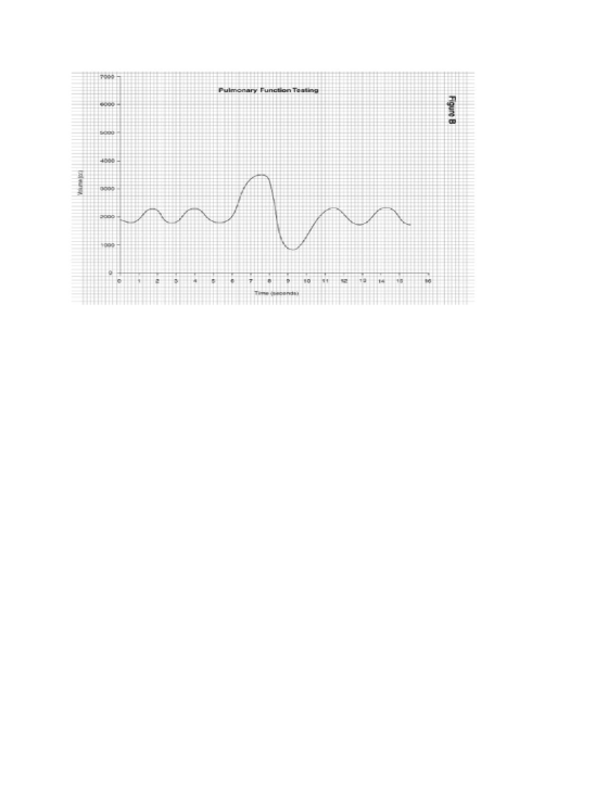 7000 Pulmonary Function Testing 3000