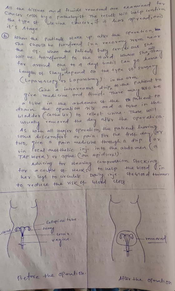 All the tissues an dd tuids removed are examned to Can cey ceUs by a patheteist The result win heip untirm the type st nar ap
