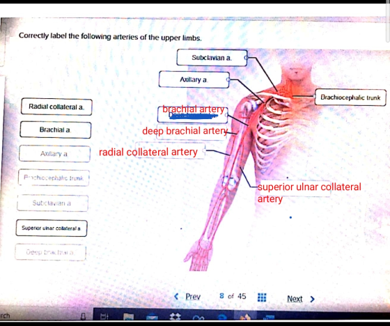 Correctly label the following arteries of the upper limbs. Subclavian a. Axillary a Brachiocephalic trunk Radial collateral a