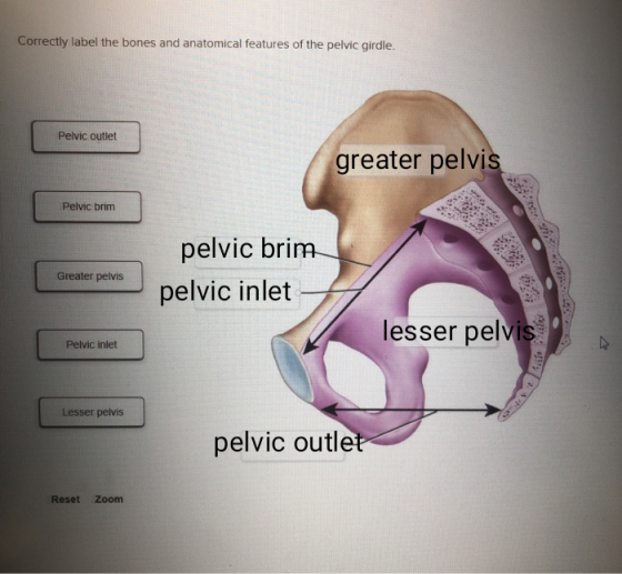Correctly label the bones and anatomical features of the pelvic girdle. Pelvic outlet greater pelvis Pelvic brim Greater pelv