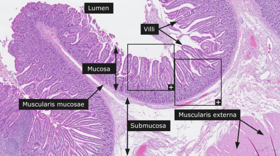 Lumen Villi SON Mucosa Muscularis mucosae Muscularis externa Submucosa