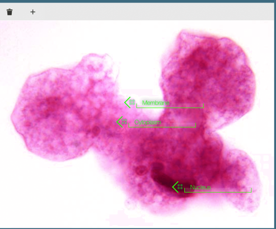 i + < Membran Membrane Cytalasin Nucleus