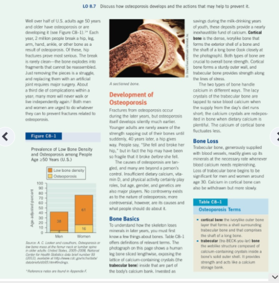 LO 8.7 Discuss how osteoporosis develops and the actions that may help to prevent it Well over half of U.S. adults age 50 years and older have osteoporosis or are developing it (see Figure C8-1).1 Each year, 2 million people break a hip, leg. arm, hand, ankle, ar other bone as a result of osteoporosis, Of these, hip fractures prove most serious. The break is rarely clean -the bone explodes into fragments that cannat be reassembled. savings during the milk-drinking years of youth, these deposits provide a nearly inexhaustible fund of calcium. Cortical bone is the dense, ivorylike bone that forms the exterior shell of a bone and the shaft of a long bone (look clasely at the pho?ographl. Both types of bone are crucial to overall bone strength. Cortical bone forms a sturdy outer wal, and trabecular bone provides strength along the lines af stress Just removing the pieces is a struggle, and replacing them with an artificial joint requires major surgery. About a third die of complications withina A sectioned bone Development of Osteoporosis Fractures from osteoporosis occur during the later years, but osteoporosis itself develops silently much earlier. Younger adults are rarely aware af the strength sapping out of their bones unbil suddenly, 40 years later, a hip gives way. Peopl hip, but in fact the hip may have been withbod vessels, readily gives up is so fragile that it broke before she fell. The two types of bone handle calcium in different ways. The lacy crystals of the trabecular bone are tapped to taise blood calcium when the supply from the days diet runs short, the calcium crystals are redepos ted in bone when dietary calcium plentful. The calcium of cortical bone luctuates less year, many more will never walk or live independently again.2Both men and women are urged to do whatever they can to prevent fractures related to Figure C8-1 Bone Loss Trabecular bone, generously supplied e say. She fell and broke her Prevalence of Low Bone Density and Osteoporosis among People Age 250 Years (U.S.) minerals at the necessary rate whenever The causes of osteoporosis are tan- eled, and many are beyand a persons control. Insufficient dietary calcium, vita min D, and physical activity certainly play roles, but age, gender, and genetics are blood calcium needs replenishing. Lass of trabecular bone begins to be significant for men and women around age 30. Calcium in cortical bone can also be withdrawn but more slowly Low bone dansity Osteoparosi and genetics areg3 90 80 70 60 50 40 30 20 o major players. No controversy exists as to the nature of osteoporosis more controversial, however, are its causes and what people should do about it. Table C8-1 Osteoporosis Terms Bone Basics To understand how the skelleton loses minerals in later years, you must first know a flew things about bones. Table C8-1 - cortical bone the ivorylike outer bone layer that forms a shell surrounding trabecular bone and that comprises the shaft of a long bone. 16 Saunce A. C. Loker and conutios, Osseoporosis aroffers definitions of relevant terms. The - trabecular (tra BECK-you-lar) bone the weblike structure compesed of calcium-containing crystals inside a bones solid outer shell. It provides strength and acts like a calcium ow bone mass at the femur neck ar mbar sphotograph on this page shows a human leg bone sliced lengthwise, exposing the 2) vailabeat w.cagochslattice of calcium-containing crystals (the Centor for Heath Stotstics dats brief number trabecular bone) inside that are part of eferance noles are tound in Appendi f the bodys calcium bank. Invested as