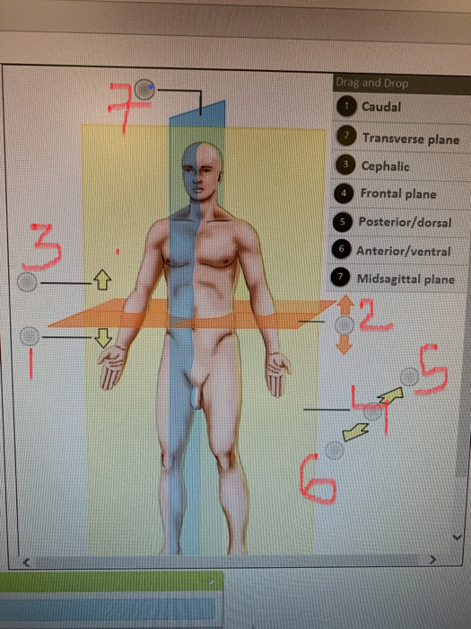 Drag and Drop Caudal Transverse plane Cephalic 4 Frontal plane Posterior/dorsal 6 Anterior/ventral 7 Midsagittal plane 5 7 2