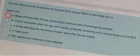 The Lost Mariners limit on memory for his past (from around 1945) is most likely due to: Select one a. Binge-drinking after