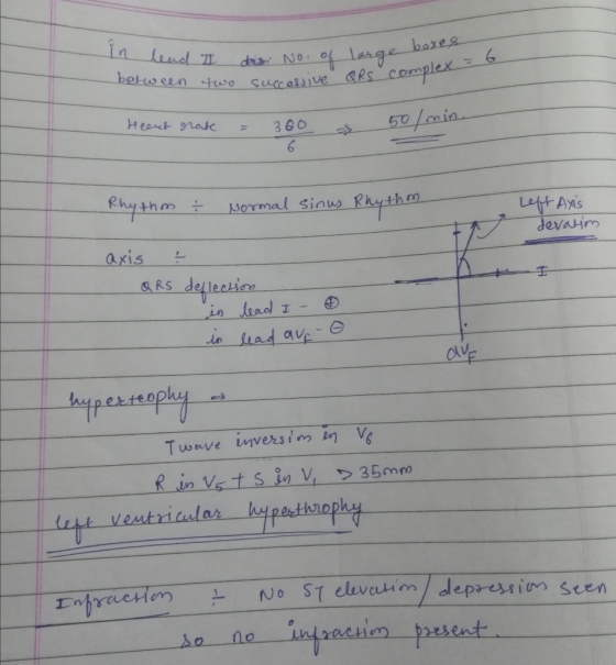 In lead I disi No. of between two successive No. of large boxes large QRS compe = 6 IRS complex Heent orate = 300 300 a 50/mi