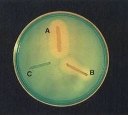DNase Test; DNA Hydrolysis Test