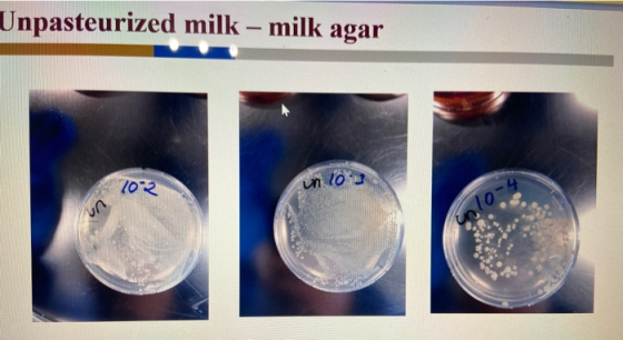 Unpasteurized milk – milk agar 702