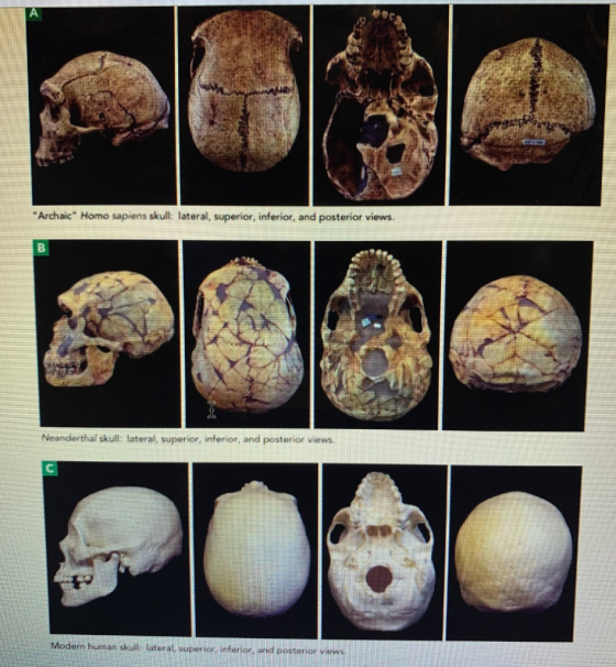 *Archaic Homo sapiens skull: lateral, superior, inferior, and posterior views. Neanderthal skull lateral, superior, inferior