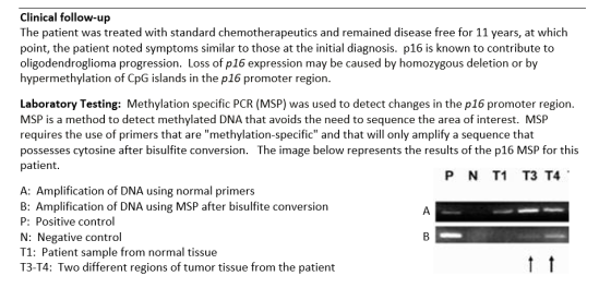 Clinical follow-up The patient was treated with standard chemotherapeutics and remained disease free for 11 years, at which p
