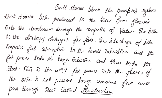 Gall stores block the pumpurs seulem that dworo bile produced in the liver from flowers into the duodenum through the ampulla
