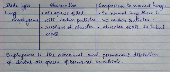 slide type | Obseevation comparison to namal lung. • airspaces filled In nouna lung there is emphyseme with carbon particles