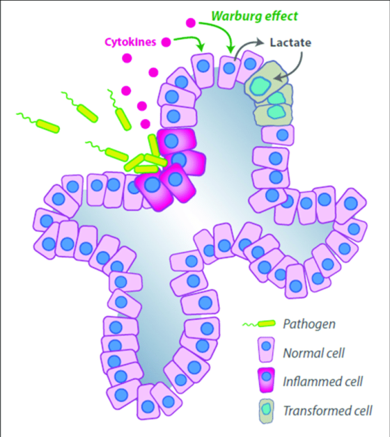 Warburg effect Cytokines Í Lactate Lactate Pathogen Normal cell Inflammed cell Transformed cell