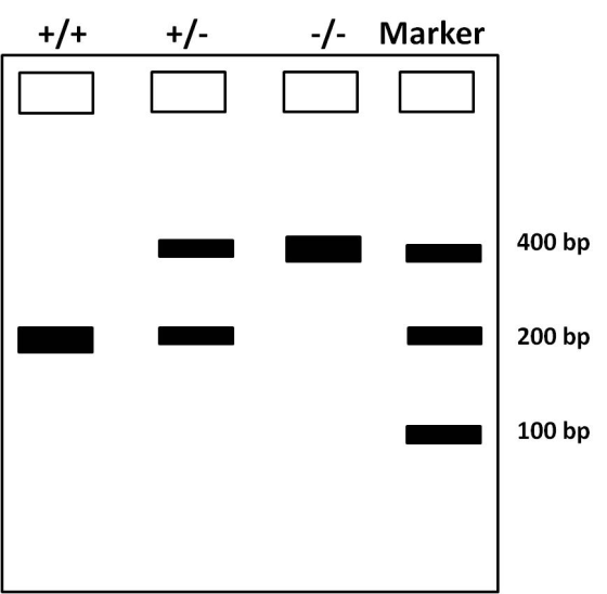-/ Marker 400 bp 200 bp 100 bp