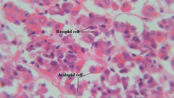 Basophil celk Acidophil cell