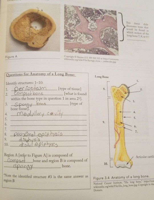 This tiue slide lustrates bone that would be found in which section of the long bone 7,8,o9 CopyrighrO Reytan (CC BY. SA 3.0)