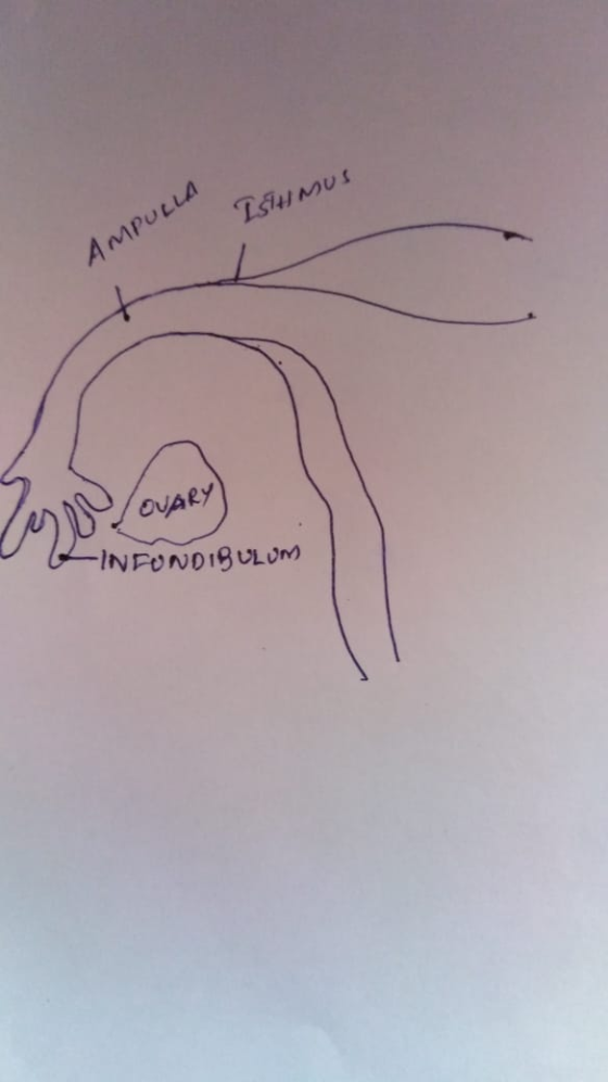 Isumus AMPULLA Job OVARY) INCONDIGULUM