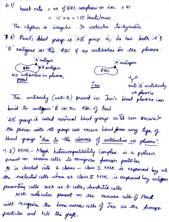 un bec xol 6-12 heart rate = no of QRS complexes 15 x 10 = 150 beats/mens The shythm is irregular. It indicates tachycardia g