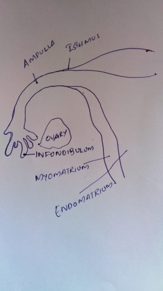 ISTHMUS AMPULLA OVARY) to V -INFUNDIBULUM NYOMATRIUND ENDOMATRIUM