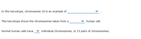 In this karyotype, chromosome 18 is an example of This karyotype shows the chromosomes taken from a human cell. Normal human