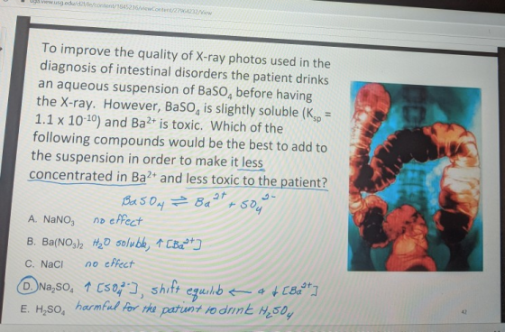 iewusg.edu/d2/le/content/1845236/viewContent/27964232/View To improve the quality of X-ray photos used in the diagnosis of in
